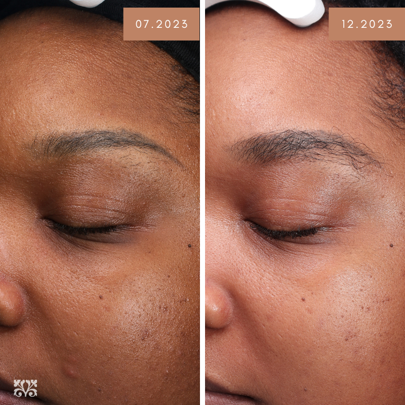 Obagi Nu-Cil Eyebrow Boosting Serum