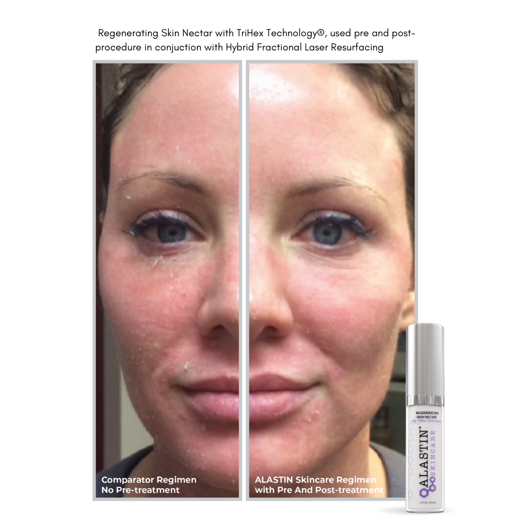Alastin Regenerating Skin Nectar