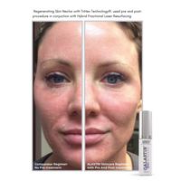 Alastin Regenerating Skin Nectar