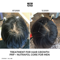 Nutrafol Men (3 Pack)