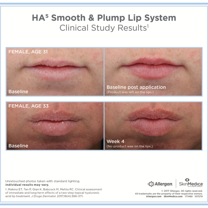 SkinMedica HA5 LIP - Smooth & Plump Lip System