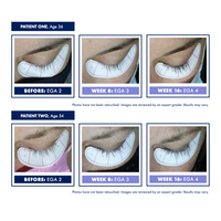 Obagi Nu-Cil Eyelash Enhancing Serum