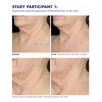 Obagi ELASTIderm Neck and Décolleté Concentrate