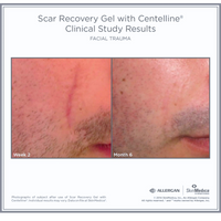 SkinMedica Scar Recovery Gel