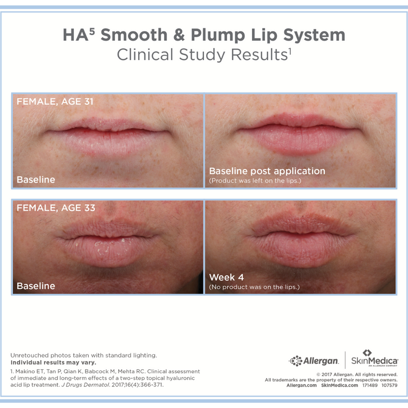 HA5 LIP - Smooth & Plump Lip System