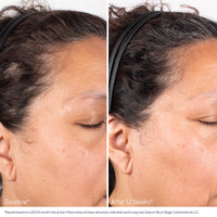 Obagi Nu-Cil Biostim Scalp Serum