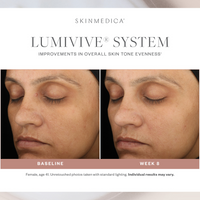 Lumivive System