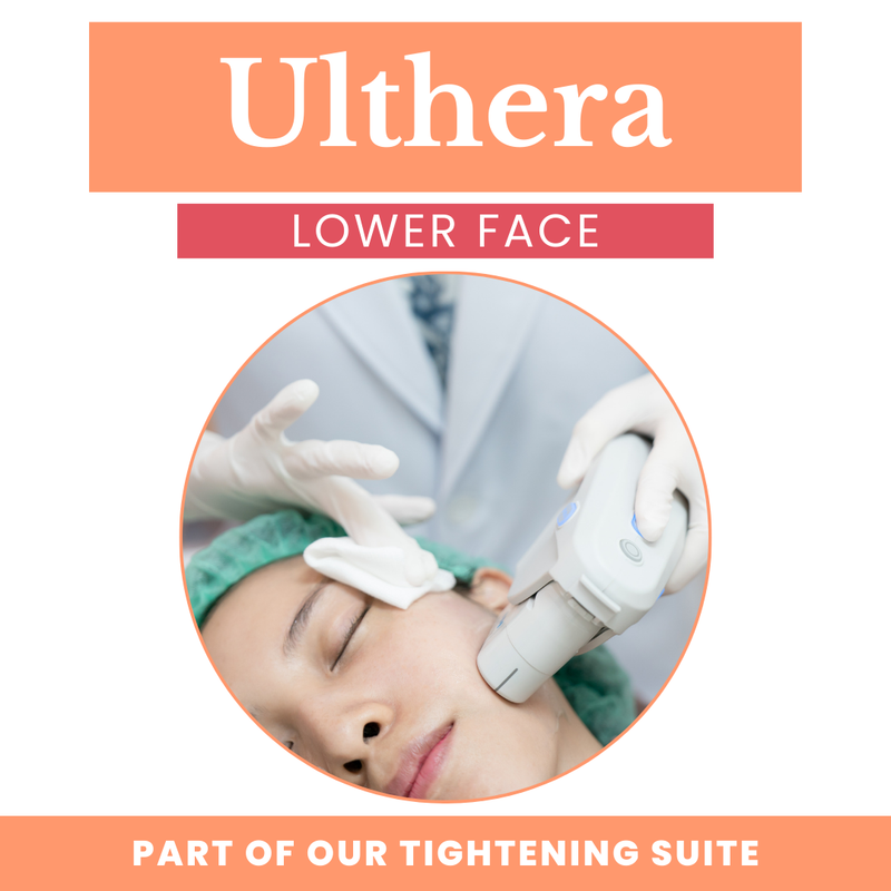 Ultherapy (Lower Face)